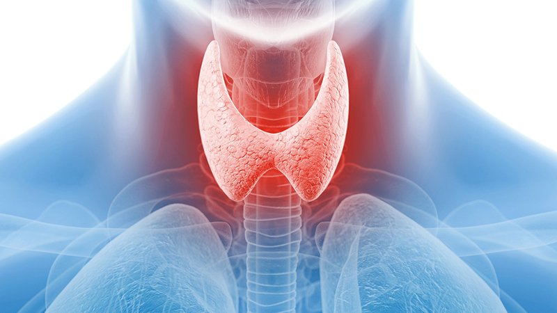 Foods to Avoid with Hypothyroidism – An Indian Diet Guide